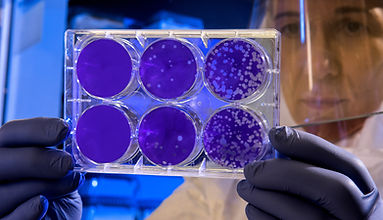 Image by CDC