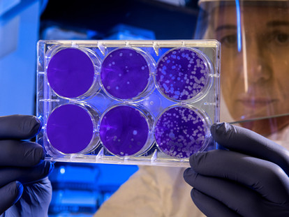 We all love trends in data and transparency in science, so why do we hate what makes these possible?