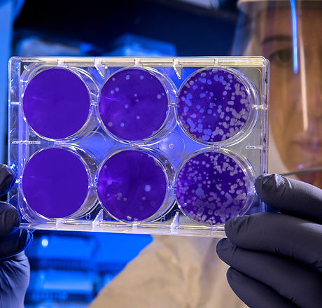 Image by CDC