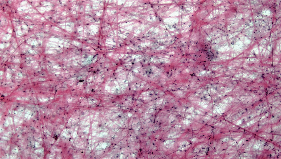 Microscopic view of fascia, illustrating its intricate network of sensory connective tissue fibers.