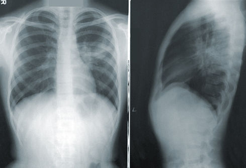 Image by CDC