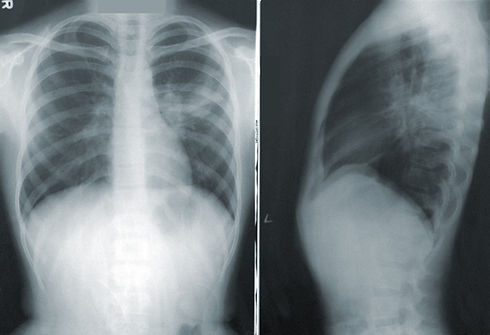 Image by CDC