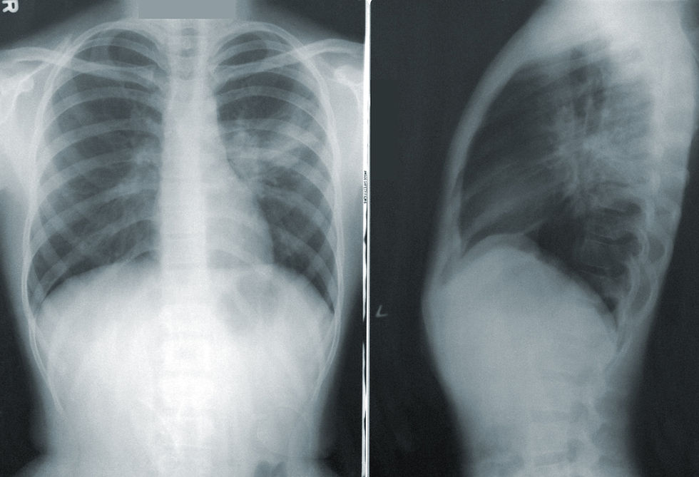 Image by CDC