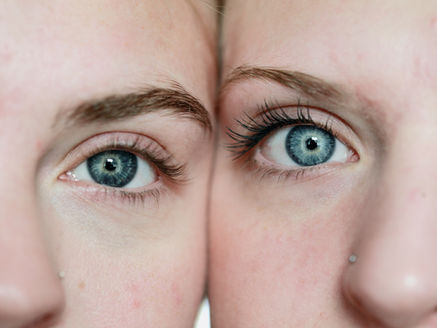 How to Lift Your Skin with Threads