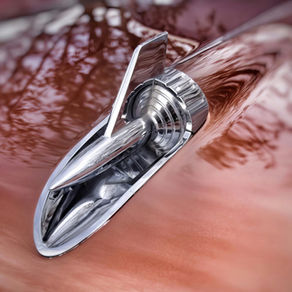 USFDA Guidance: For Patient-Matched Guides Used in Orthopedic Implants