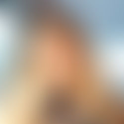 Is teeth whitening permanent?