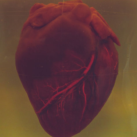 Should I get a Coronary Artery Calcium Test?