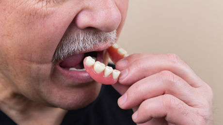 Restoring Your Smile: Solutions for Missing Teeth at Encompass