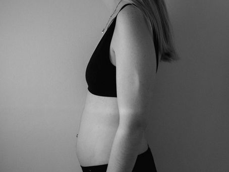 Post-Pregnancy Body Transformation: Recovery Tips for Mommy Makeover Success