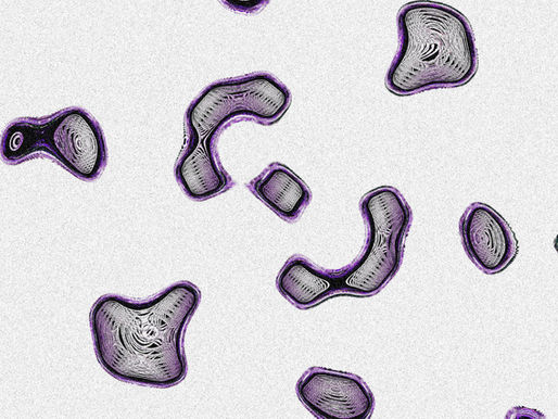 Oocyte Retrieval and Handling: Techniques and Protocols