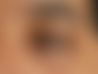 Close-up of a human brown eye with visible eyelashes, eyelid texture, and natural skin details. | South Bay Retina, San Jose, Gilroy