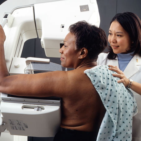 Mammograms, who should get squished?