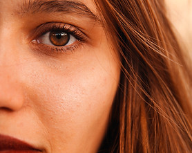 Microneedling after treatment
