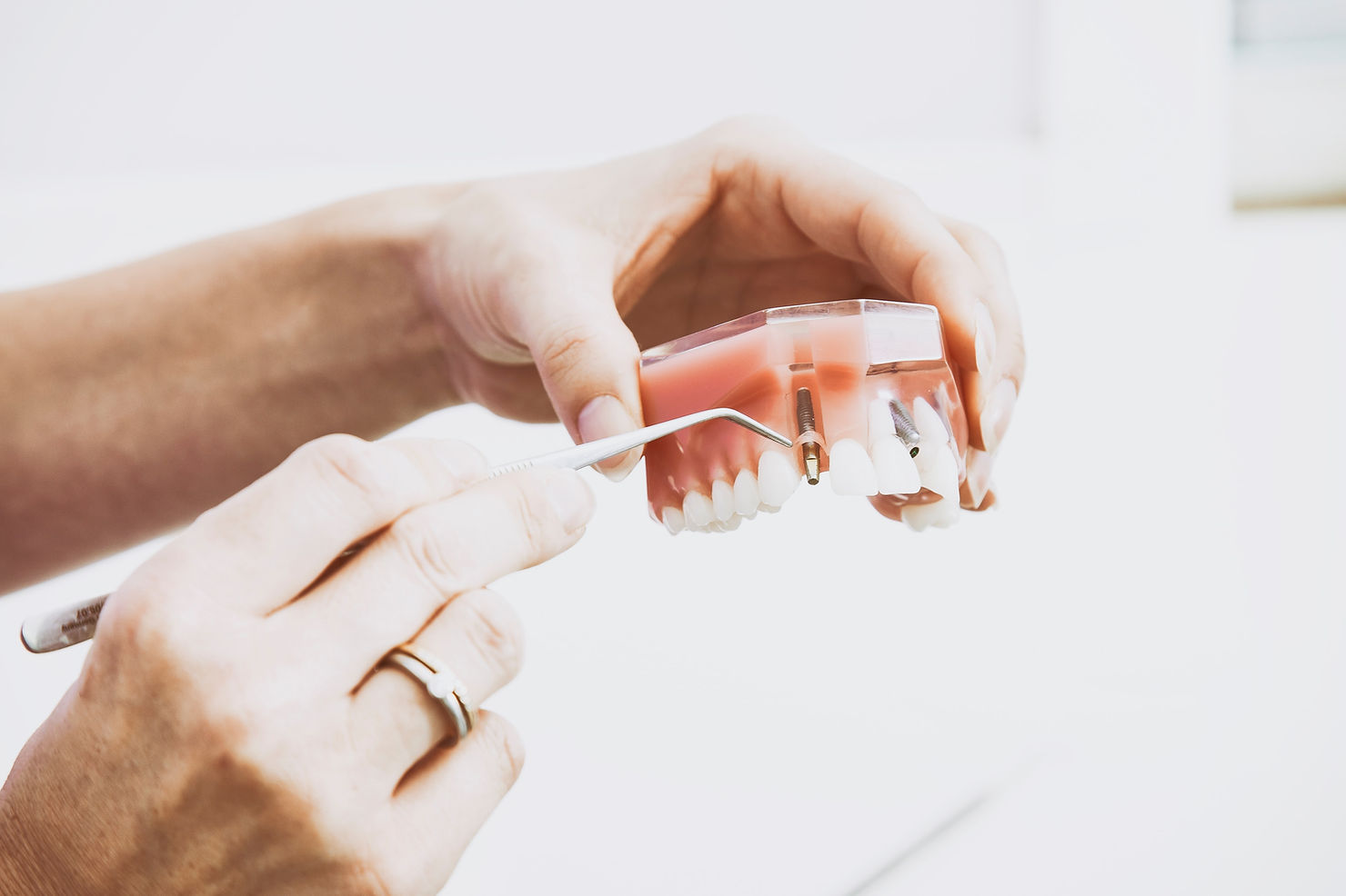 Hands holding a dental model, using a tool to demonstrate implants. White background, close-up, educational setting.