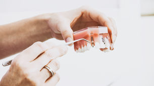 Rebuild Your Smile - Dental Implants