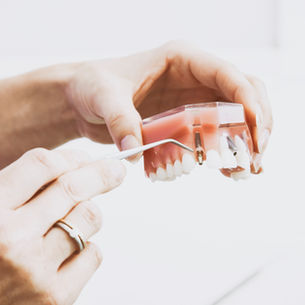 Does my Insurance Cover Dental Implants?