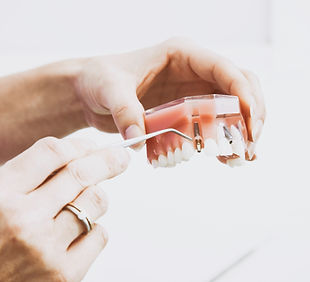 Implant maitnenance