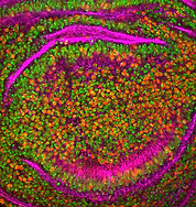 Image de National Cancer Institute