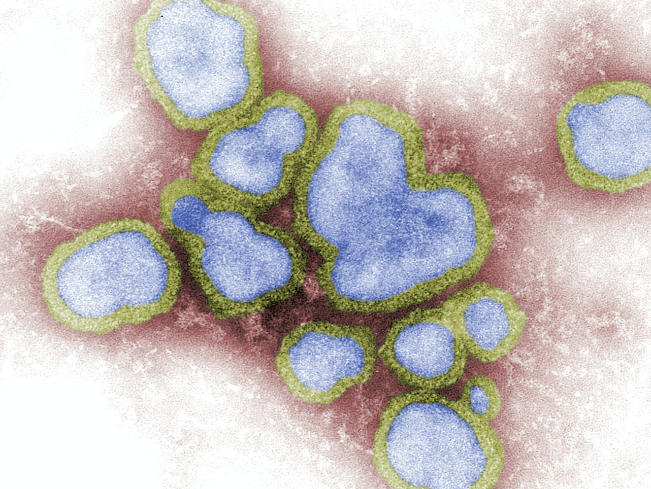 Image by CDC