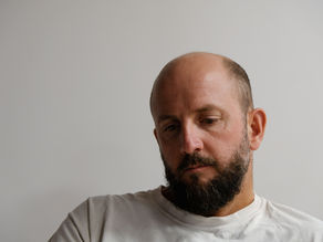 Mann mit Haarausfall