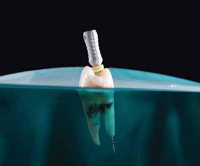 Image by Ozkan Guner