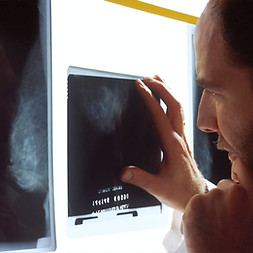 Image by National Cancer Institute