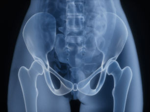 Recovery Timeline: What to Expect After a Private Hip Operation