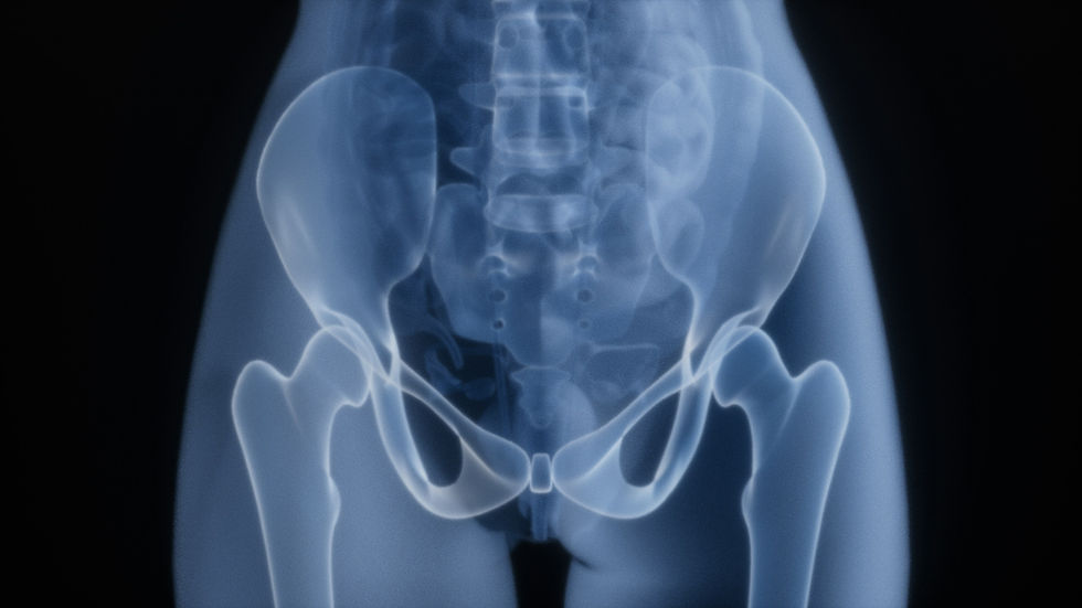 Overworked and Under Treated: Releasing the Deep Rotators of the Hip