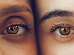 Unveiling the Hidden Truths of Early Glaucoma Detection: A Shift Beyond Traditional Diagnosis