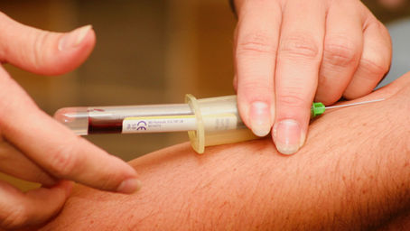 תרומת דם ואימונים עצימים (אירובי ואנאירובי)