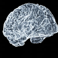 Sam Altman is hedging bets on startup that seeks to rewire brain