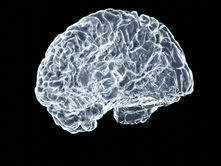 Sam Altman is hedging bets on startup that seeks to rewire brain
