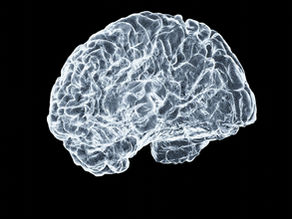 When the brain breaks. What happens when neurological errors change our life forever? 