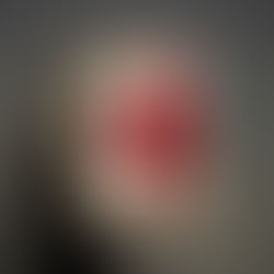 Red cross and red crescent scale back aid as crises grow