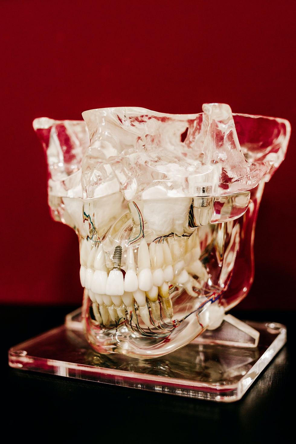 dental implant model