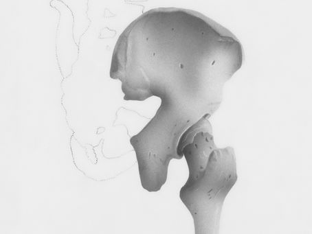Common Hip Conditions: A Guide to Hip Pain and What Might Be Causing It