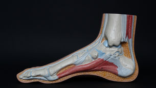 Fersensporn: Ursache, Symptome und Behandlung | schmerzcenter.com