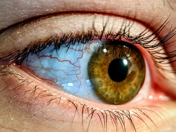 【眼精疲労】目の疲れ・頭痛・肩こりが続く方へ|八王子市 万町接骨院