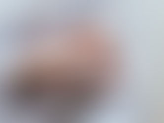 Ellerim, parmaklarım neden şiş?