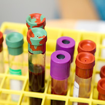 Image by National Cancer Institute