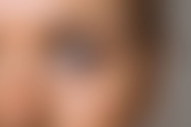 The Overlooked Keys to Clear Skin: 5 Simple Steps to Banish Blemishes and Acne