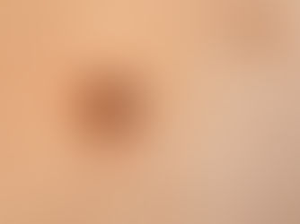 ארבל: פרזיט מפריס פרסה (ח"א)