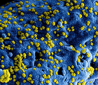 Image by CDC