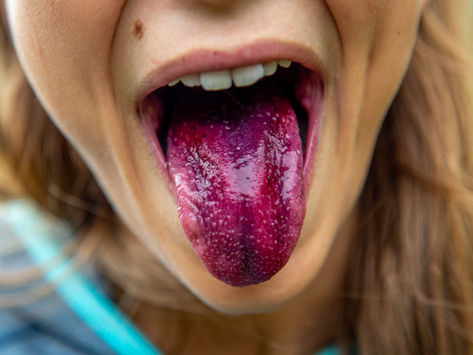 ¿Raspas tu lengua por las mañanas?