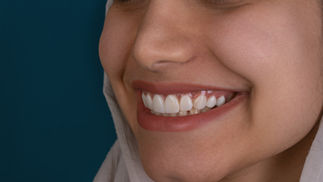 Close-up of a person smiling, showcasing white teeth and clear skin, against a dark blue background. The mood appears happy and content.