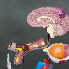a brain model in sagittal section