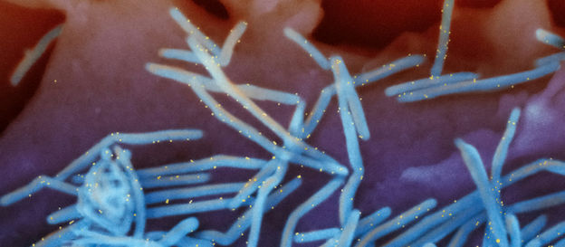 Microorganisms under the microscope