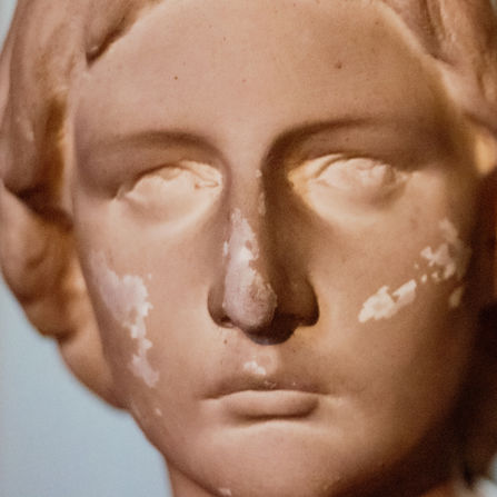 Les Infections Invasives à Méningocoques