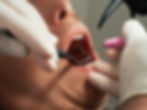Bright Oak Dental - dental extractions