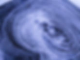 Understanding Neurodegenerative Disorders